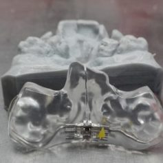 IMG_20161114_180110 (2)